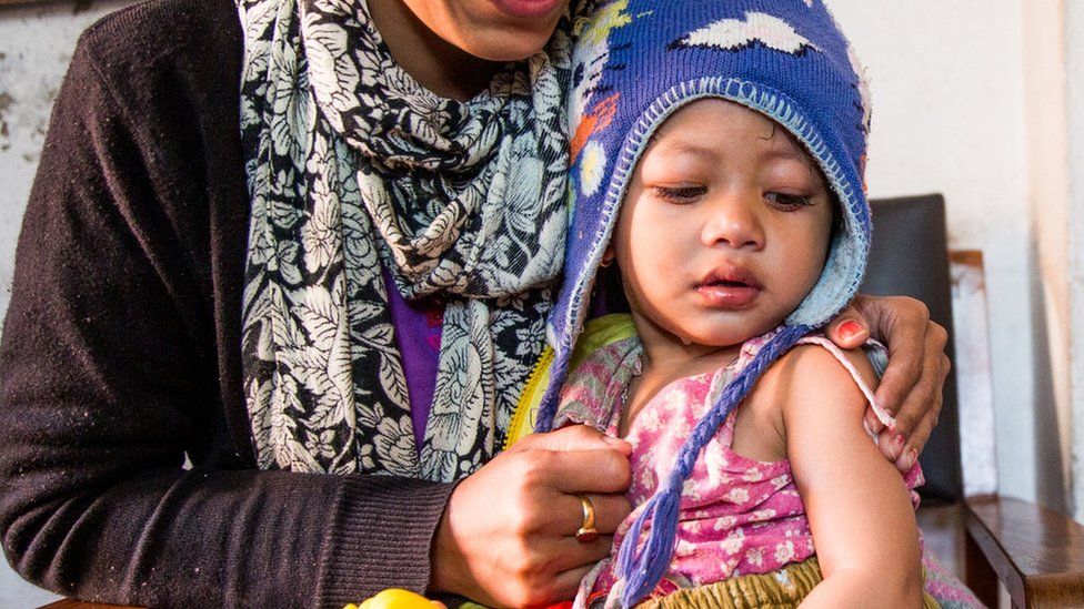 Child being vaccinated