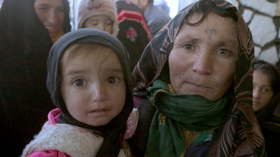 Woman and child wait for nutrition packs in Ghor