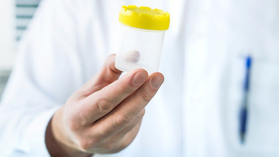 Doctor holding a clear container