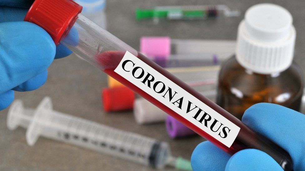 Testing blood for antibodies for coronavirus