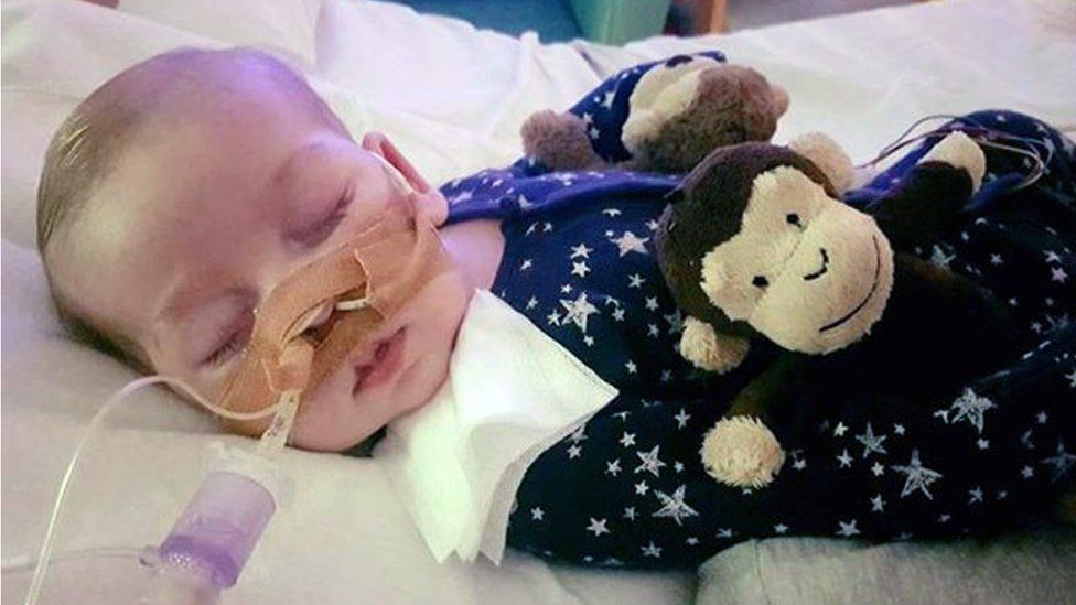 Charlie is thought to be the 16th baby ever to be diagnosed with his condition