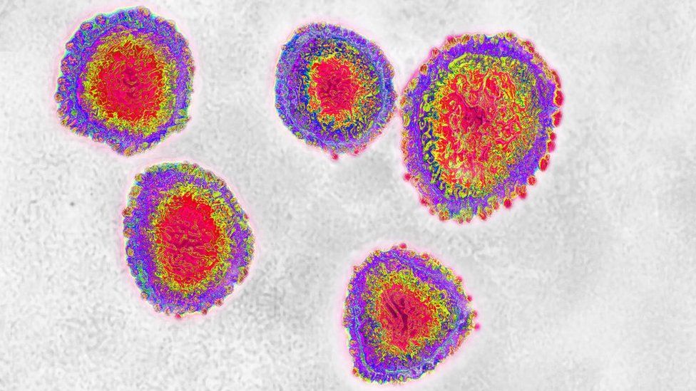 diferentes formas de un virus y sus partes