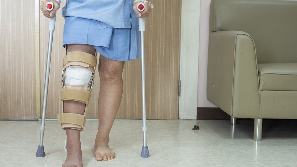 Patient standing on crutch in hospital ward ware knee brace support after do posterior cruciate ligament surgery
