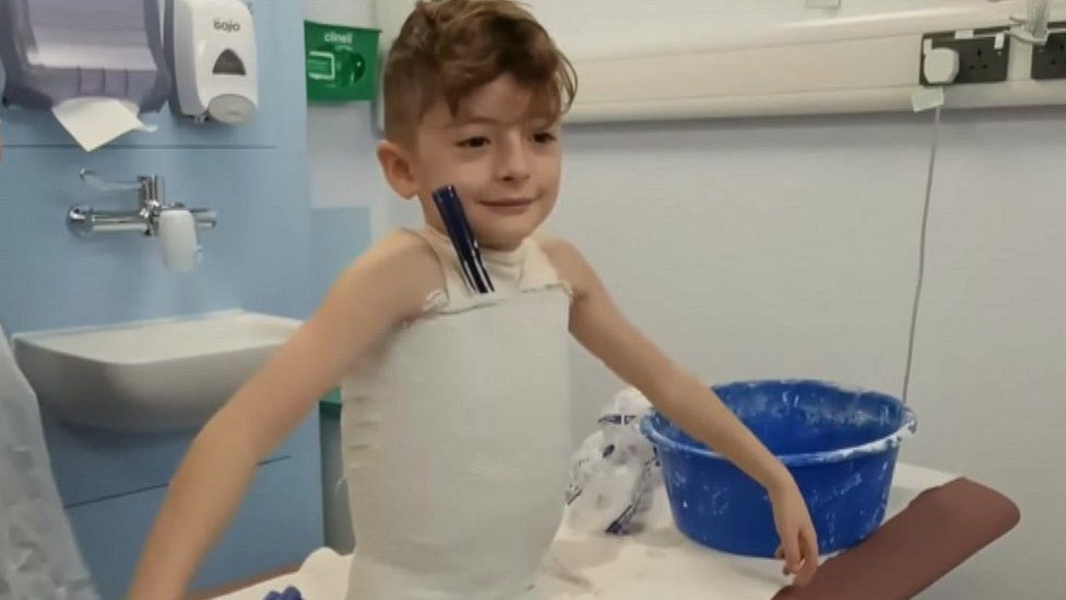 Nottingham Bear braces help young patients face spine therapy BBC News