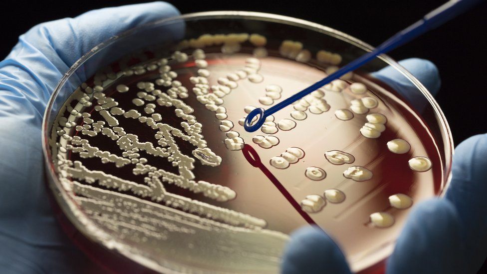 Ученый изучает супербактерию MRSA в образце крови