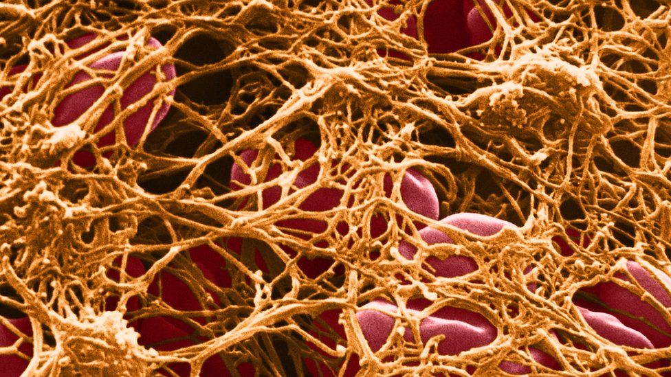 electron microscope image of a blood clot