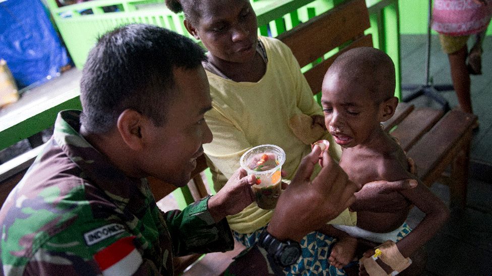 A member of the Indonesian military attends to a child at the local hospital in Agats