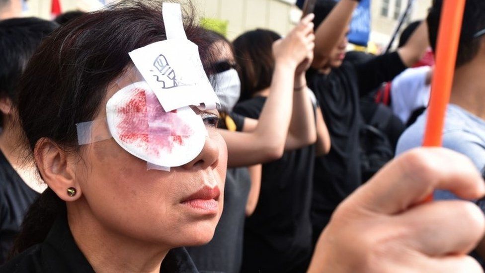 A pro-Hong Kong democracy supporter wears a patch on one eye and a drawing that depicts salt on a wound during a rally in Vancouver