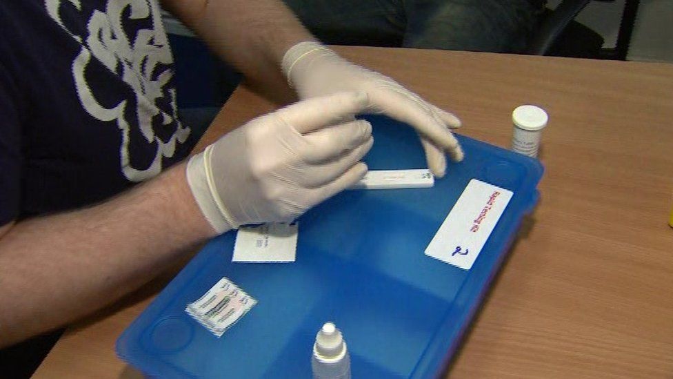 HIV 94 new cases detected in Northern Ireland in year BBC News