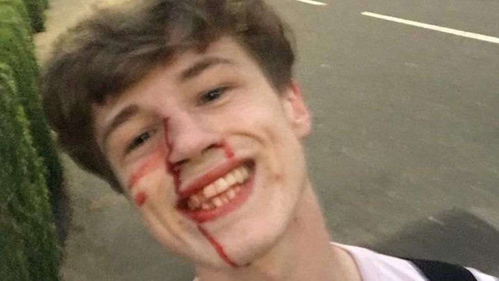 Blair Wilson with blood on his face