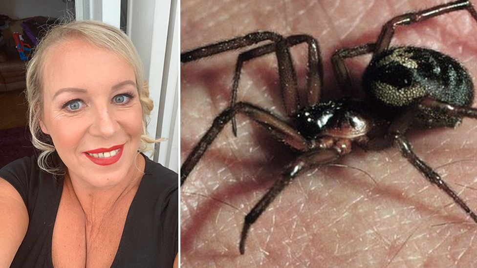 false-widow-spider-bite-leaves-barry-woman-in-hospital-bbc-news