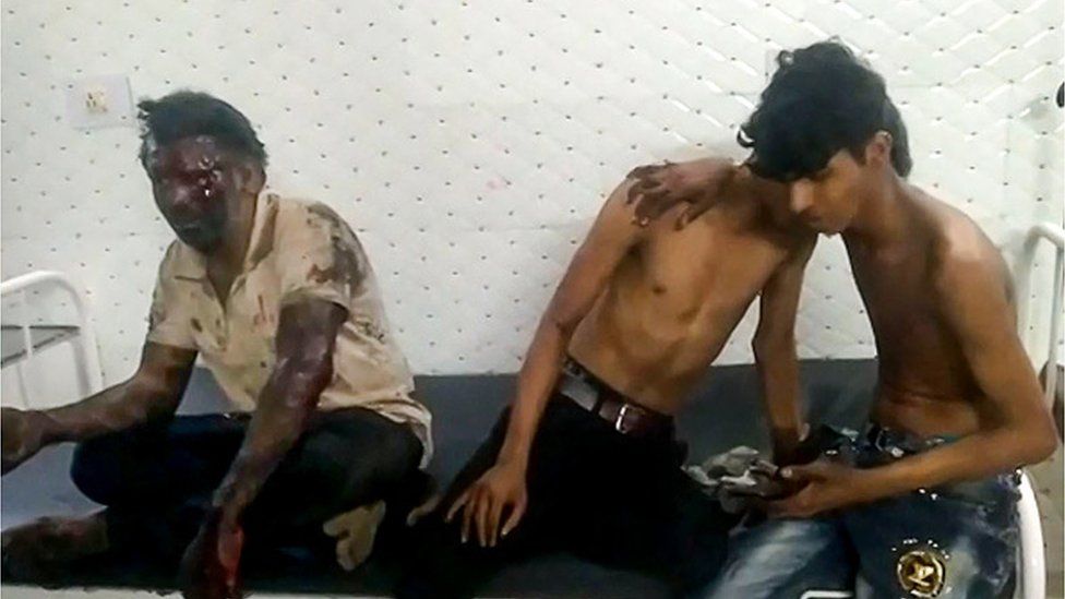 Graphic content / This frame grab taken from an AFPTV video footage on June 3, 2023 shows injured survivors waiting to receive treatment at the Bhadrak District Hospital after a horrific three-train collision that took place near Balasore, about 200 kilometres (125 miles) from Bhubaneswar, capital of eastern India's Odisha state.