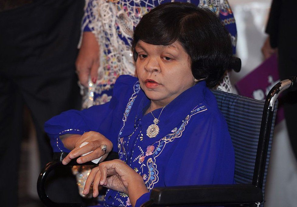 ET, Myanmar's most famous fortune teller, sits on a wheelchair as she attends a local television program in Bangkok on 23 July 2012.