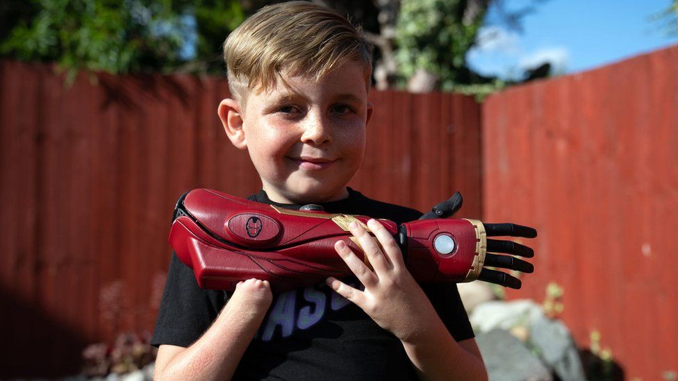 Louie Morgan-Kemp with his new bionic arm