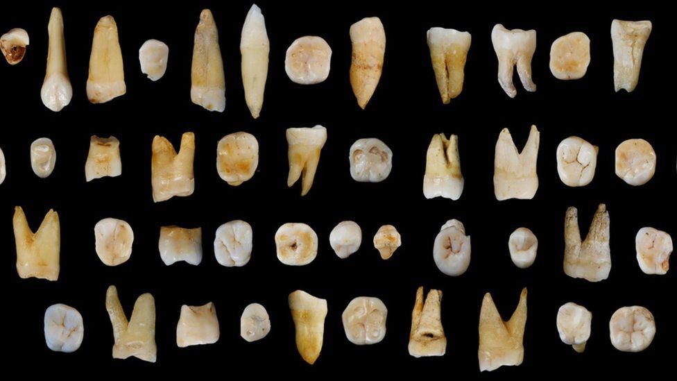 an array of human teeth from the cave site