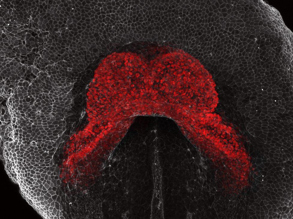 An image in grey and red showing the heart of a mouse