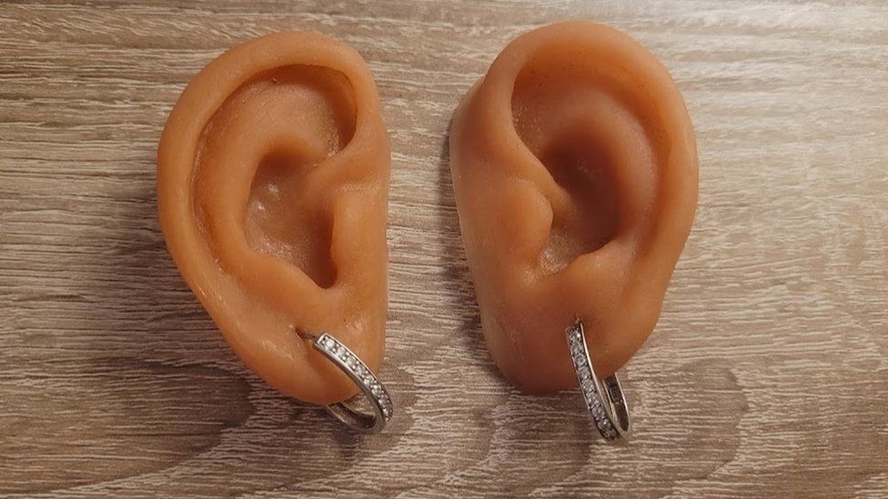 Janet Craven's artificial ears