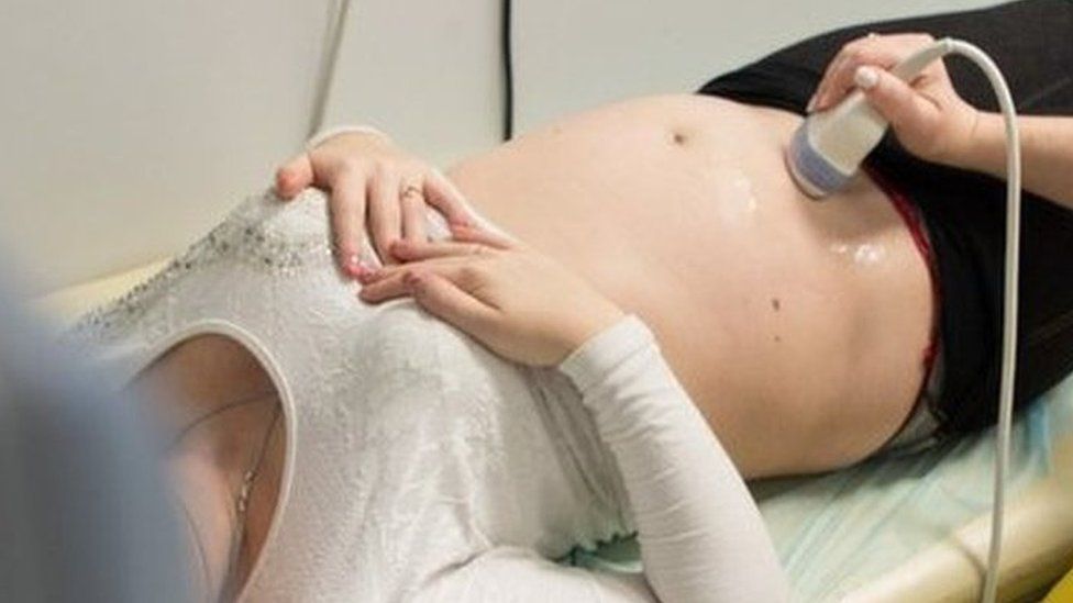 A doctor runs an ultrasound probe over the stomach of a pregnant surrogate at the Ilaya clinic