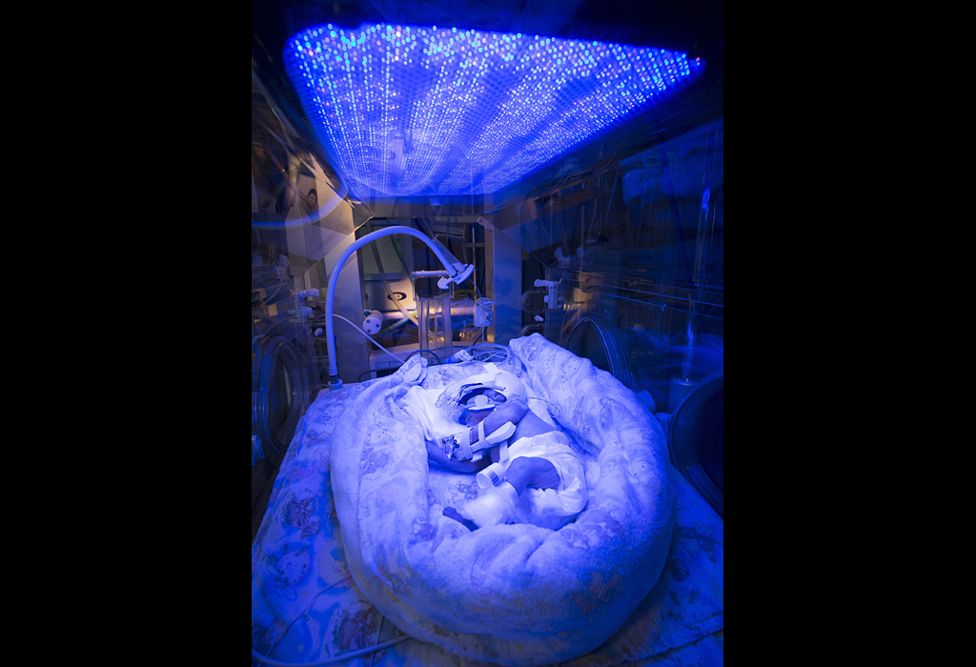 Premature baby receiving light therapy - David Bishop, Royal Free Hospital, London