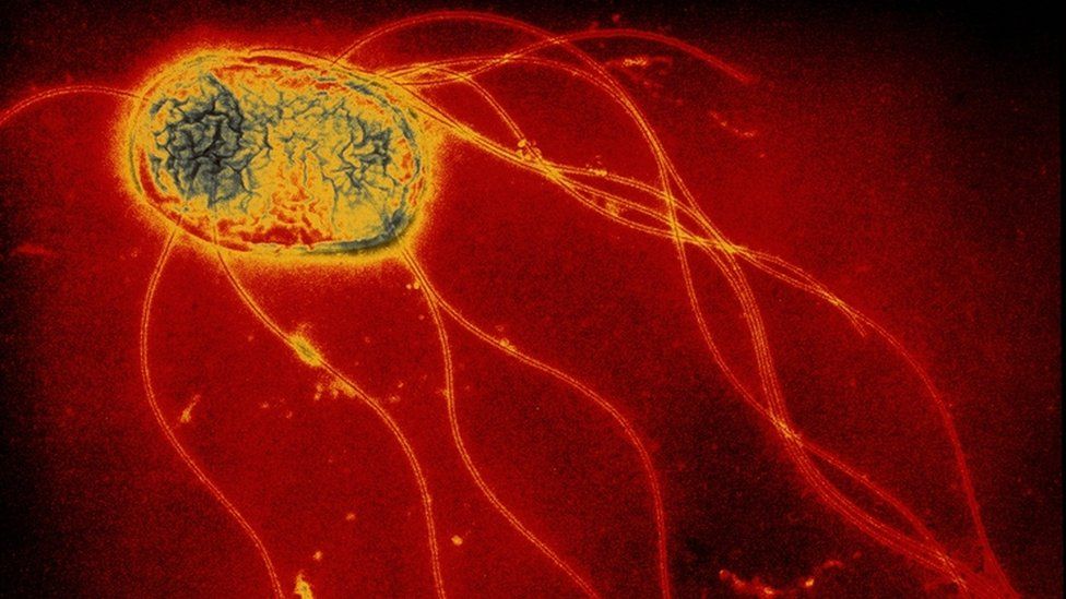 Salmonella victim taken to hospital three days after first ambulance call BBC News