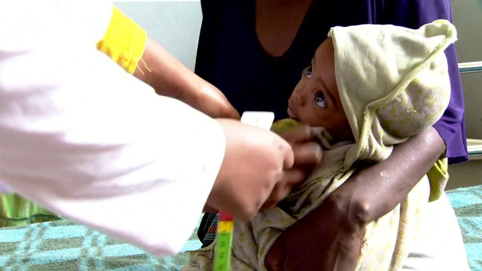 Baby in Ethiopian hospital