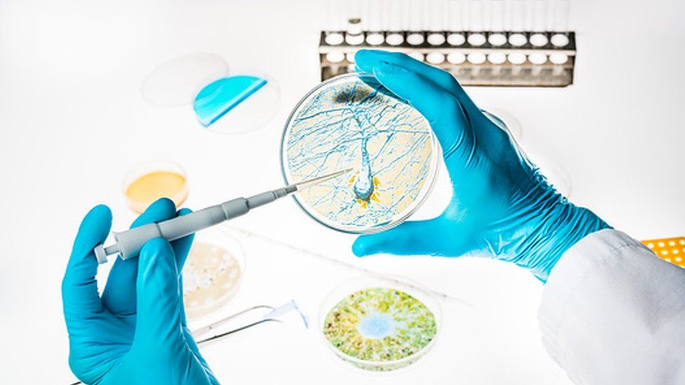 Research into Alzheimer's in the lab with a petri dish