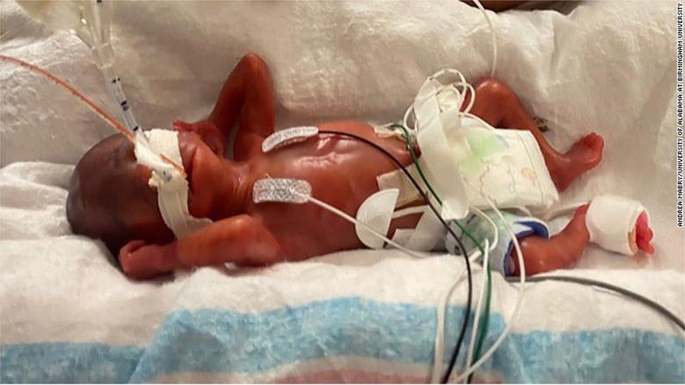 Preemie baby hot sale