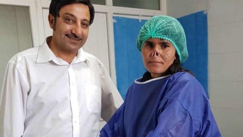 Dr Zalmai Khan Ahamadzai with Zarka before the operation