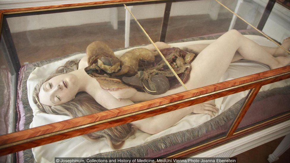 Josephinum, Collections and History of Medicine, MedUni Vienna/Photo Joanna Ebenstein