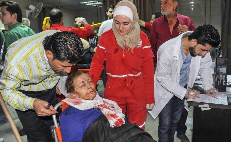 A woman with facial injuries receives first aid at an emergency room in Al Mouwasat Hospital, Damascus
