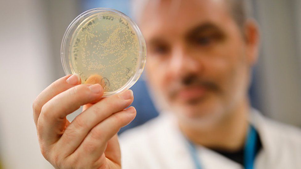 Koronavirus Azərbaycan iqtisadiyyatına nə qədər ziyan vurur? – AÇIQLAMA