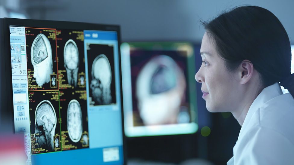 Doctor looking at MRI scans on a screen