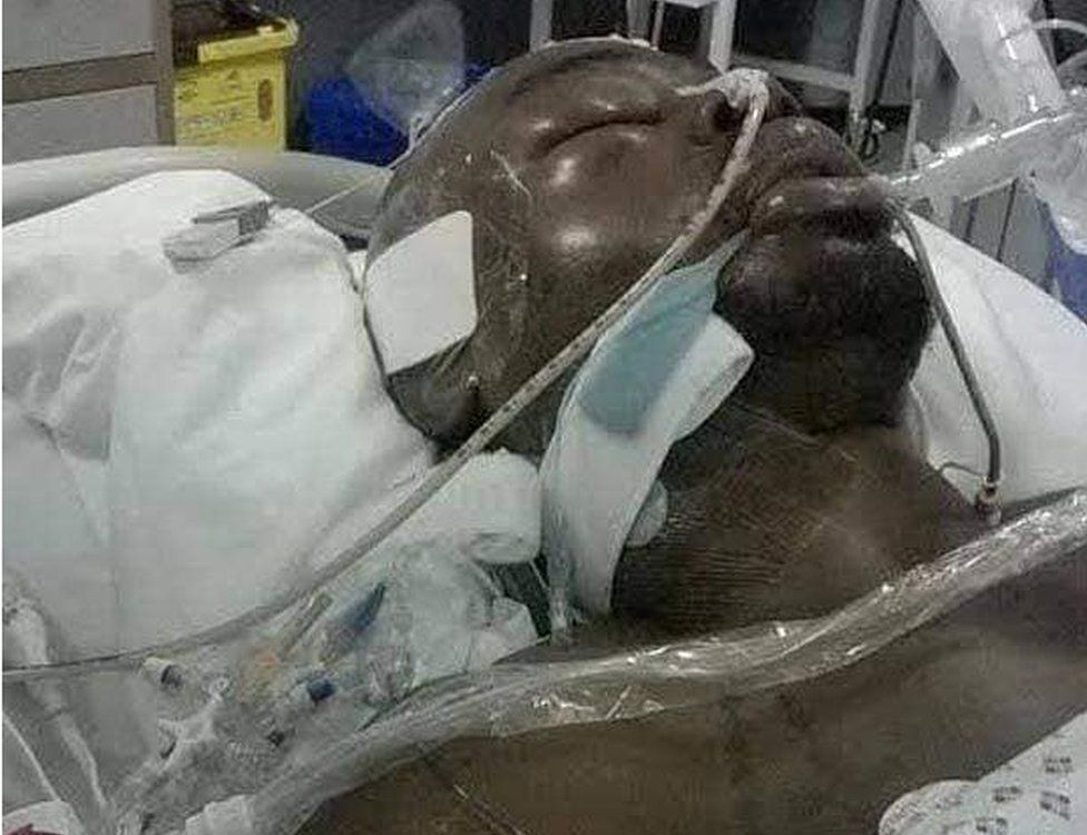 Jerome pictured in hospital