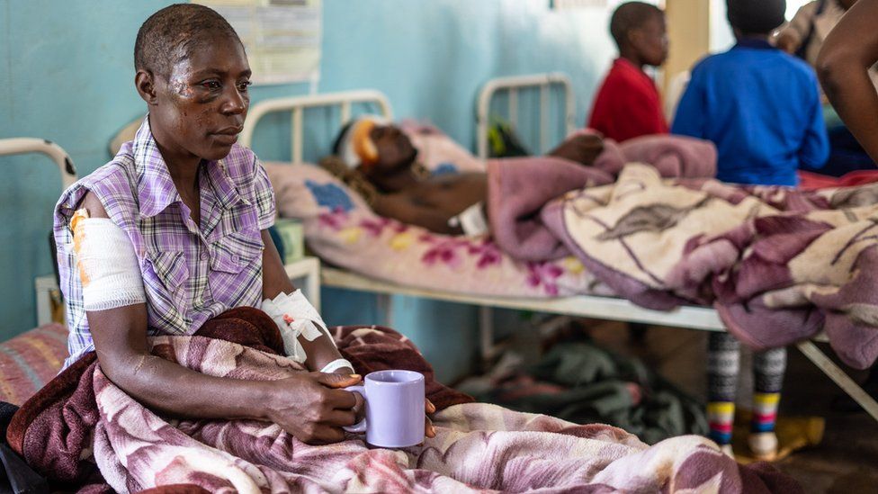 Praise Chipore, 31, sits on a hospital bed at Chimanimani rural district hospital, Zimbabwe, on March 18 2019