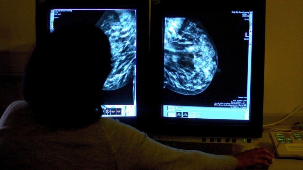 Silhouette of a consultant looking at a screen showing a mammogram. 
