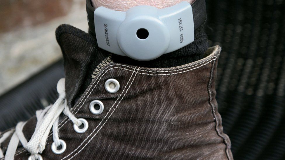 Electronic tag on a man's ankle. These tags are used to monitor the movements of criminals