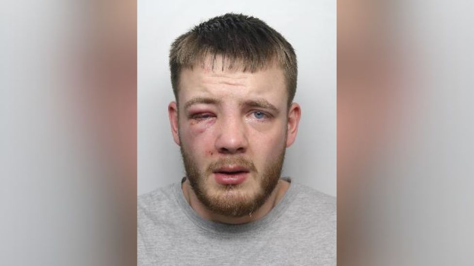 Police mug shot of Leon Roberts, pictured with a black eye