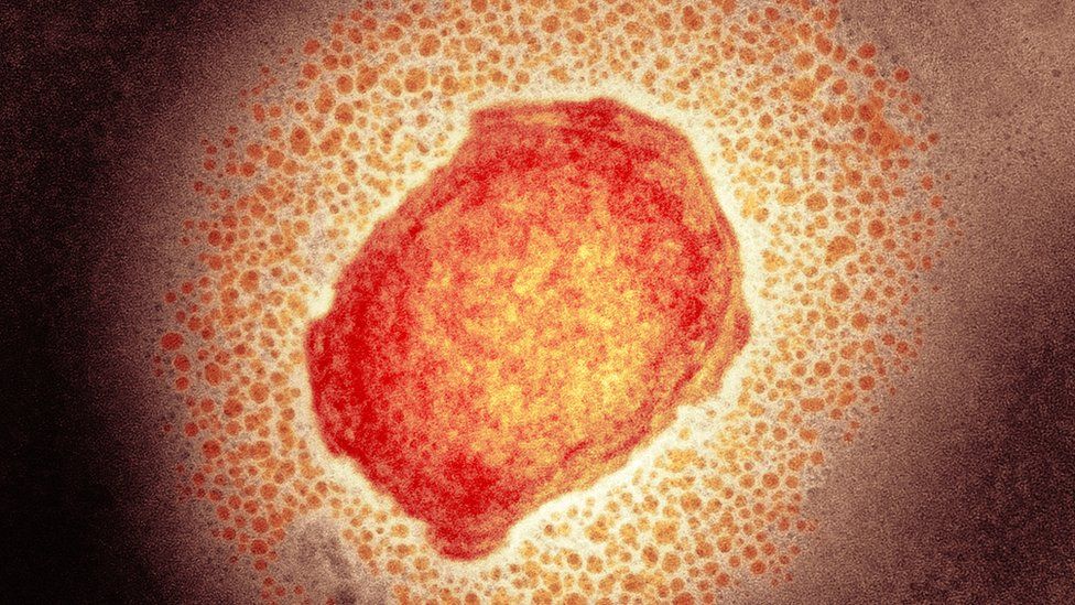 Particule du virus monkeypox