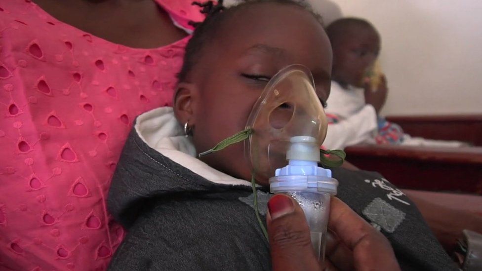 Two-year-old Thayi at Senegal's Albert Royer Children's Hospital
