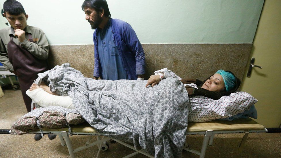 An injured woman is pictured after she received treatment at a hospital a day after a bomb blast and gun fire at a military hospital in Kabul