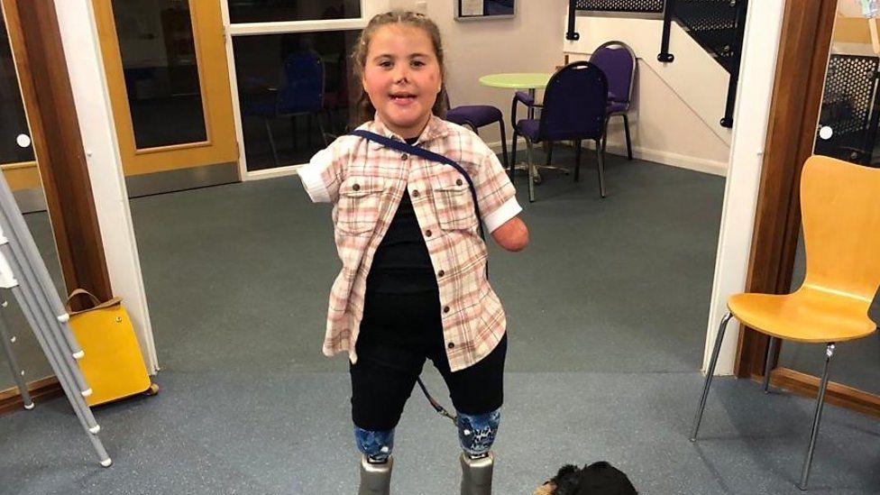 Harmonie standing on her prosthetic legs