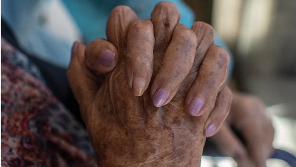 A nail without nail polish to allow oxygen measures is seen on Concepció Zendrera hands in Spain in May