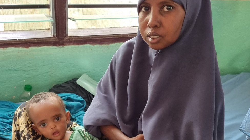 350,000 Somali Children at Risk of Dying from Malnutrition Amid Country’s Worst Drought in a Decade