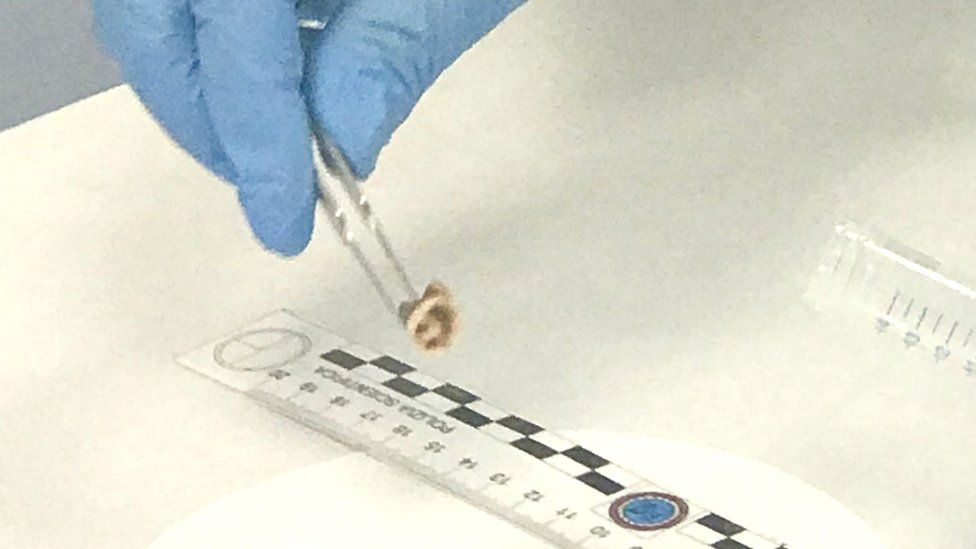 A handout picture released by the Italian Police shows a forensic officer analysing a tooth of the French skier, Henri La Masne, found in 2005, 29 July 2018