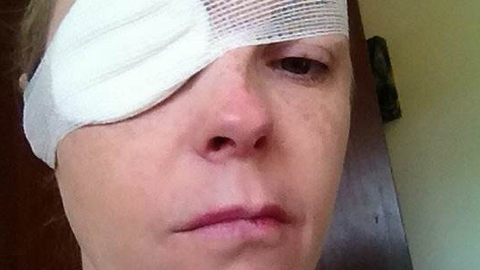 Ms Foulkes-Davies wearing an eye patch