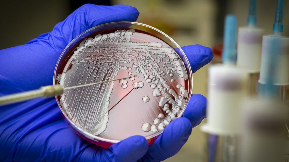 Bacteria growing on a plate