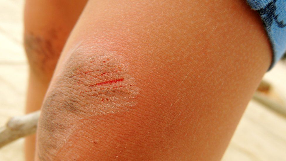 why-mouth-wounds-heal-faster-than-skin-scrapes-discover-magazine