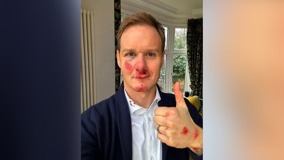 Dan Walker back in the saddle after Sheffield cycle crash BBC News