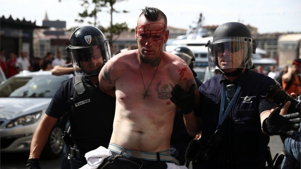 A bloodied England fan was among a number detained by police