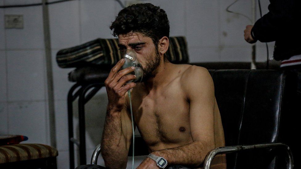 A man recovering from injuries received by chemical weapons in Syria's Eastern Ghouta